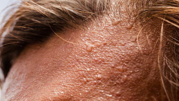 10 Frequent Hyperhidrosis Myths, Debunked 1 10 Common Hyperhidrosis Myths Debunked