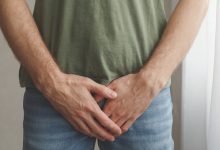 An Overview of Concealed Penis