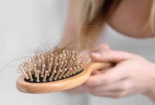 Diabetes can cause hair loss handy tips to prevent