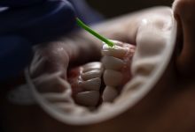 Say goodbye to tobacco stains Expert tips on restoring your