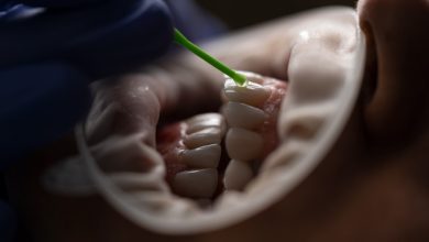 Say goodbye to tobacco stains Expert tips on restoring your