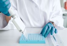 Severe COVID 19 Linked to Undiagnosed Cancer