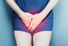 Sweaty around vagina Dont just blame the hot weather