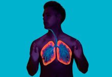 What a Severe Asthma Attack Looks Like