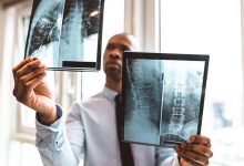 cs ways to prevent long term joint damage from ankylosing spondylitis 01 722x406