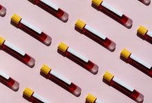 All About Paroxysmal Nocturnal Hemoglobinuria PNH