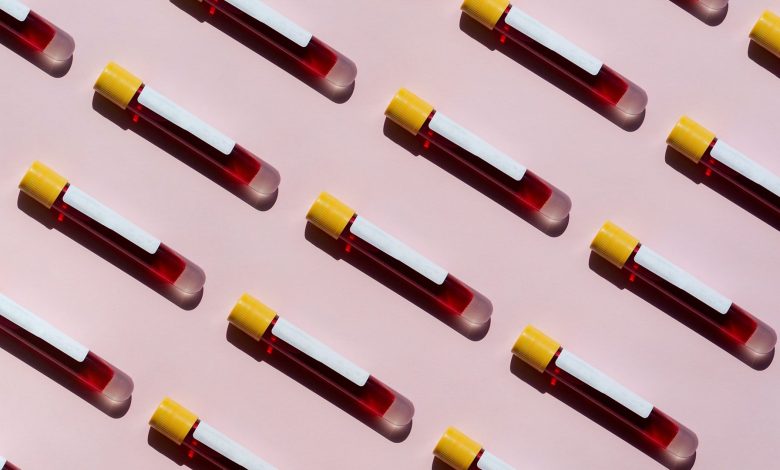 All About Paroxysmal Nocturnal Hemoglobinuria (PNH) 1 All About Paroxysmal Nocturnal Hemoglobinuria PNH