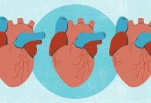 American Heart Association Releases First Guideline Overhaul in a Decade