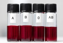 Blood Type May Affect COVID 19 Infection Risk