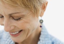 Hypothyroidism and Weight Gain Dry Skin and Hair Loss