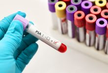 Purpose Results Benefits and Risks