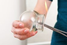 What Is Cupping Therapy
