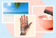 Why Is Vitiligo Getting Worse