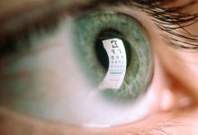 Early Signs of Multiple Sclerosis