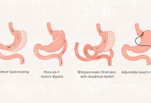 How It Works Benefits Foods and More