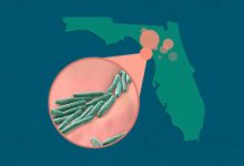 Leprosy Cases on the Rise in Florida According to CDC