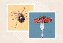 Red Meat Allergy Called Alpha Gal Syndrome May Be Prevalent in