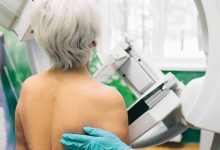 Screening Mammograms Lead to Overdiagnosis of Breast Cancer in Older