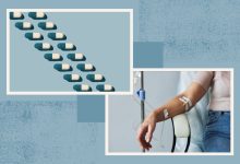 Treatment and Medication Options for Fabry Disease