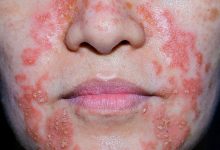 What Do the Types Look Like