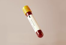 Blood Test to Diagnose Long COVID Could Be On Its