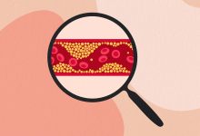 Can High Cholesterol Cause Blood Clots