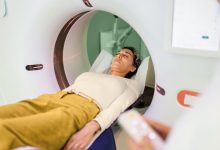 Estrogens Role in Lung Cancer Is Complicated