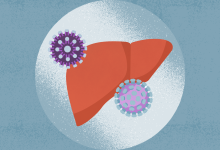 Managing Hepatitis C and HIV