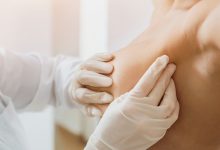 Symptoms Causes Diagnosis and Treatment