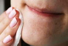 The Best and Worst Ways to Get Rid of Blackheads