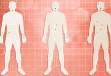 Timeline of HIV Symptoms