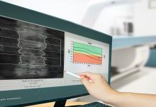 What Is It Like to Get a Bone Mineral Density