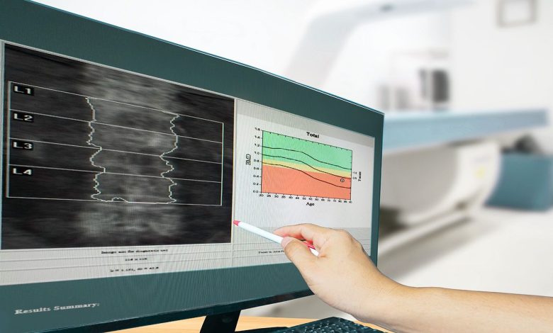 What Is It Wish to Get a Bone Mineral Density Scan 1 What Is It Like to Get a Bone Mineral Density