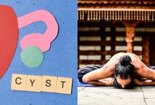 1698748124 5 best yoga asanas for ovarian cyst