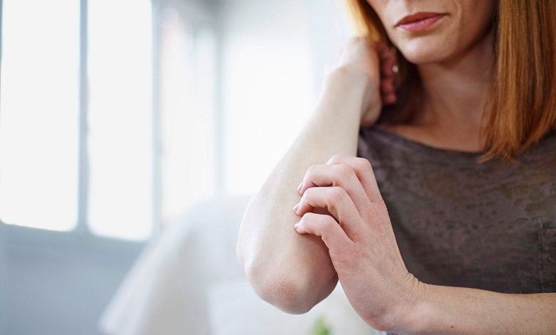 8 Methods to Relieve Your Psoriasis Itch 1 8 Ways to Relieve Your Psoriasis Itch
