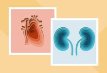 CKM Syndrome a Newly Identified Disorder Raises Heart Attack Risk