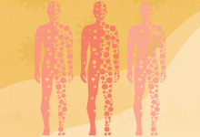 COVID 19 Could Increase the Risk of Autoimmune Disorders