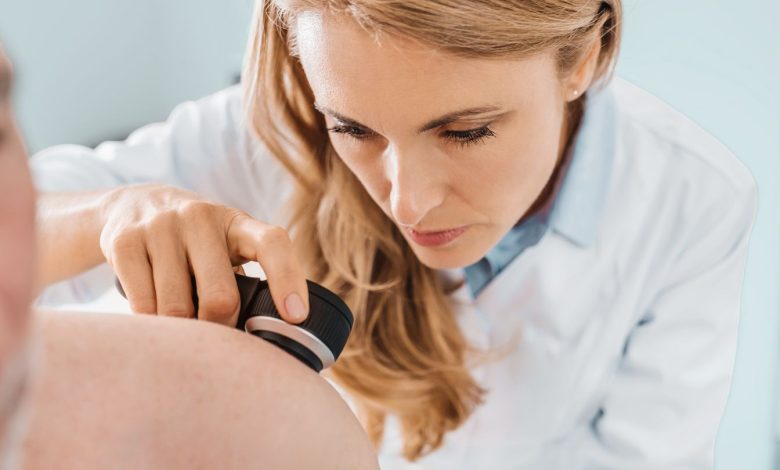 Melanoma Is Not the Solely Pores and skin Most cancers That Can Kill 1 Melanoma Is Not the Only Skin Cancer That Can Kill