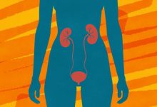 Recurring UTIs Frequent and Chronic