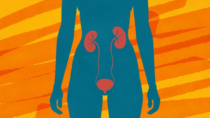 Recurring UTIs: Frequent and Power 1 Recurring UTIs Frequent and Chronic