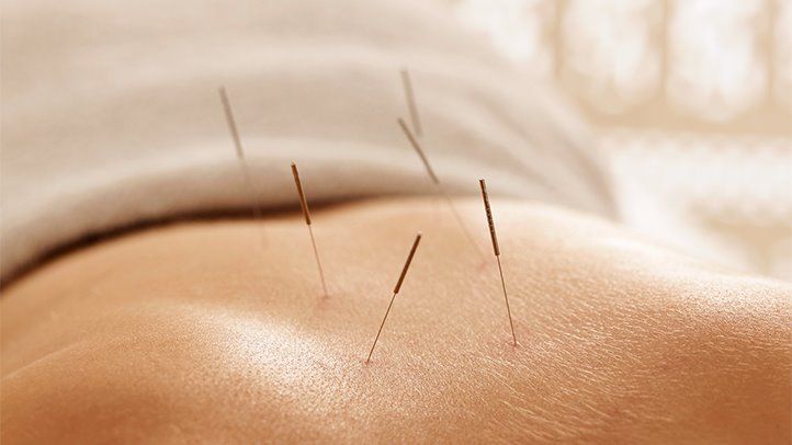 Sexual Health Might Enhance With Acupuncture Remedies 1 Sexual Health May Improve With Acupuncture Treatments