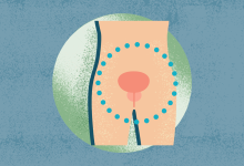 Symptoms Stages Diagnosis Treatment and More