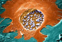 10 Essential Facts About Chlamydia