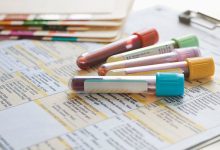 10 Factors That Affect Thyroid Levels