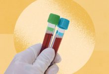 Black Men Have Higher Risk of Prostate Cancer Than White