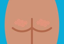 How to Get Rid of the Bumps on Your Behind
