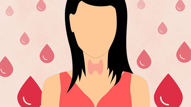 Hypothyroidism and Irregular Intervals 1 Hypothyroidism and Irregular Periods
