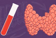 7 Important Health Checks for People With Hypothyroidism