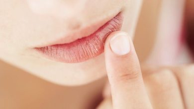 Chapped Lips Causes Treatments and Prevention