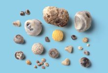 Crohns Complications The 411 on Gallstones